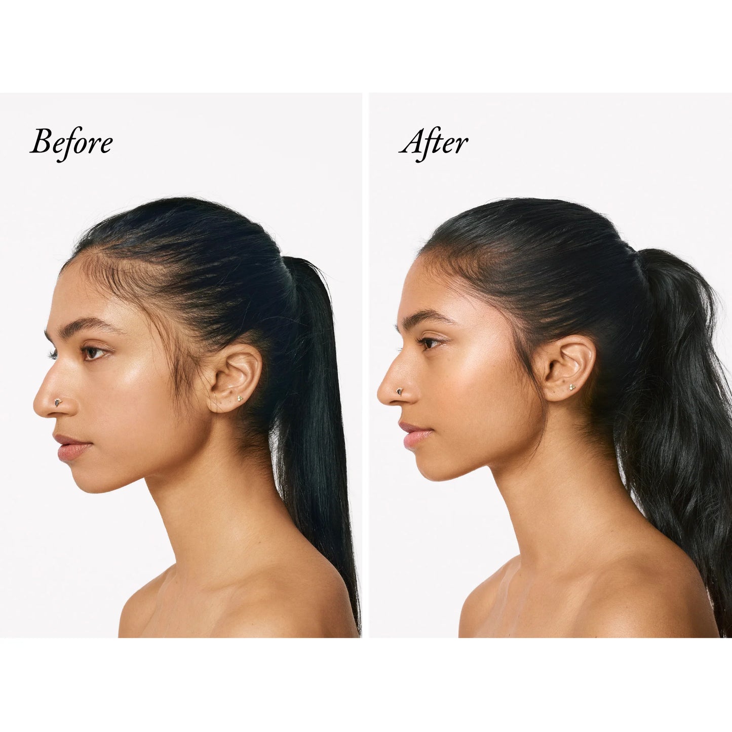 Serene Scalp Thickening Treatment Spray - 125 ml